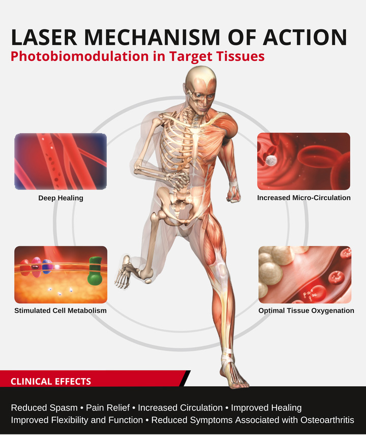Laser mechanism of action: deep healing, increased micro-circulation, stimulated cell metabolism and optimal tissue oxygenation